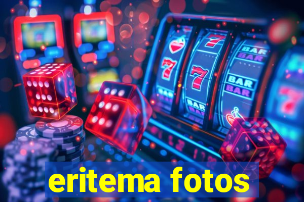 eritema fotos